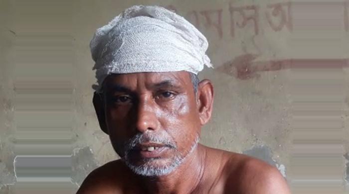 গোবিন্দগঞ্জে পারিবারিক কলহের জেরে ধারাল অস্ত্রের আঘাতে পিতা-পুত্র আহত গোবিন্দগঞ্জে পারিবারিক কলহের জেরে ধারাল অস্ত্রের আঘাতে পিতা-পুত্র আহত