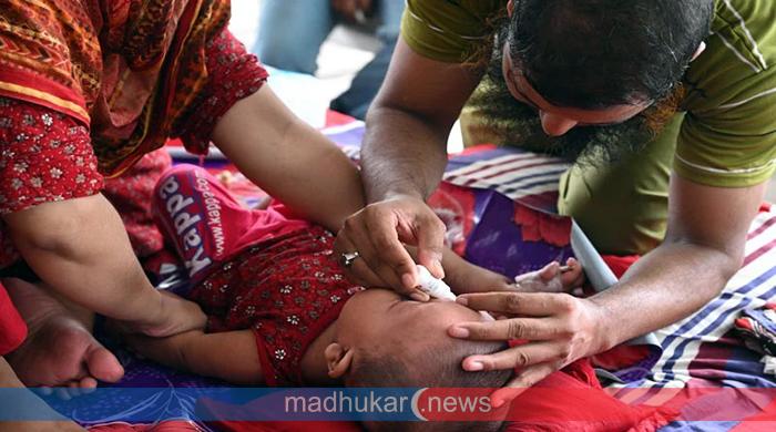 দেশে হাম ও হামের উপসর্গে আরও ১৭ শিশুর মৃত্যু দেশে হাম ও হামের উপসর্গে আরও ১৭ শিশুর মৃত্যু