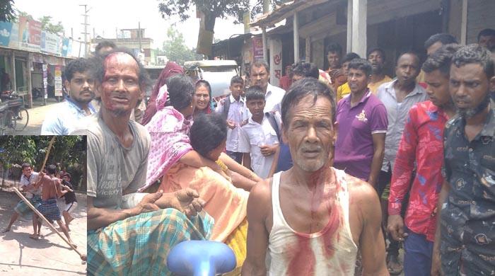 মালিবাড়ীতে গাছ কাটা নিয়ে মারামারি, মহিলাসহ আহত-৩