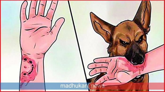 সুন্দরগঞ্জে পাগল কুকুরের কামড়ে ৪ জনের মৃত্যু, আক্রান্ত ১২জন