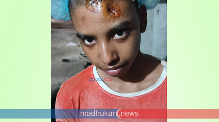 সাঘাটায় ক্রিকেটব্যাট দিয়ে শিশুর মাথার হাড় ভেঙে দেওয়ার অভিযোগ 