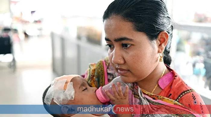 সিলেটে হাম উপসর্গে আরও ৩ শিশুর মৃত্যু, মোট প্রাণহানি ৪০