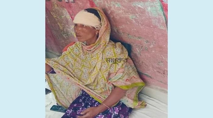 শেয়ালের কামড়ে ৯জনের শরীরেই জলাতঙ্ক নিশ্চিত