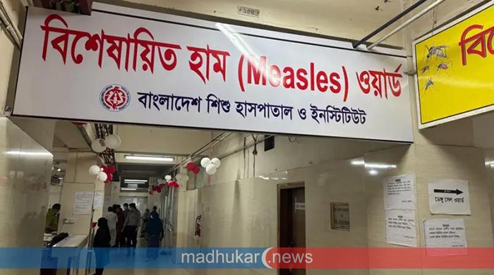 হাম ও উপসর্গে আরও ৮ জনের মৃত্যু