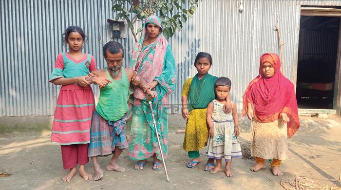ছয় সদস্যের পরিবারের চারজনই খর্বাকৃতির