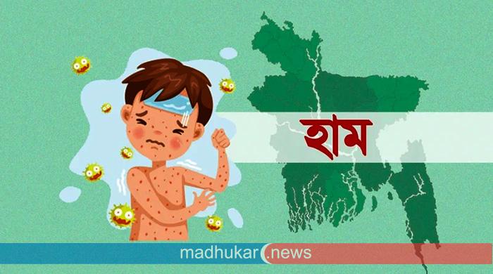 হামের উপসর্গে আরও ৮ শিশুর মৃত্যু